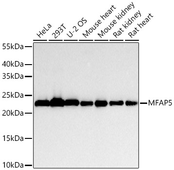 MFAP5 Rabbit Polyclonal Antibody