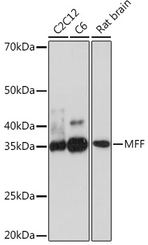 MFF Rabbit Monoclonal Antibody