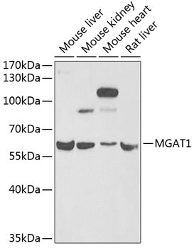 MGAT1 Rabbit Polyclonal Antibody