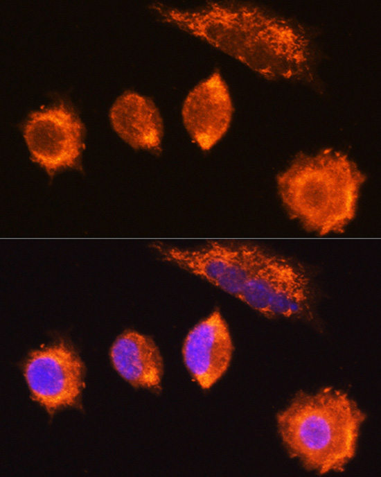 MGAT1 Rabbit Polyclonal Antibody - Image 2