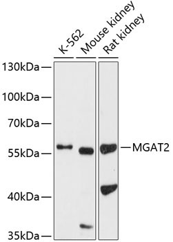 MGAT2 Rabbit Polyclonal Antibody