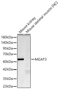 MGAT3 Rabbit Monoclonal Antibody