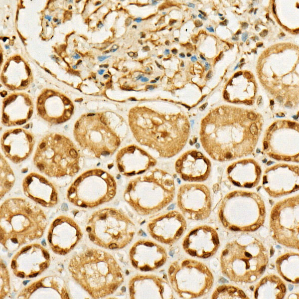 MGEA5 Rabbit Polyclonal Antibody - Image 2