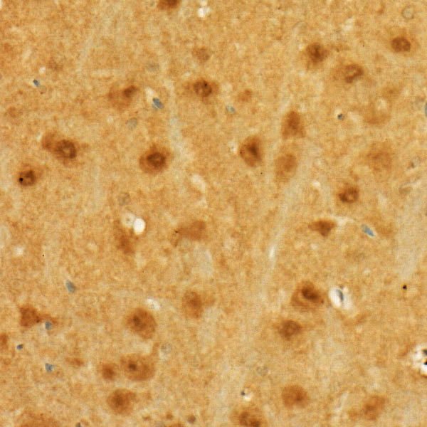 MGEA5 Rabbit Polyclonal Antibody - Image 3
