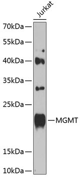 MGMT Rabbit Polyclonal Antibody