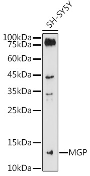 MGP Rabbit Polyclonal Antibody
