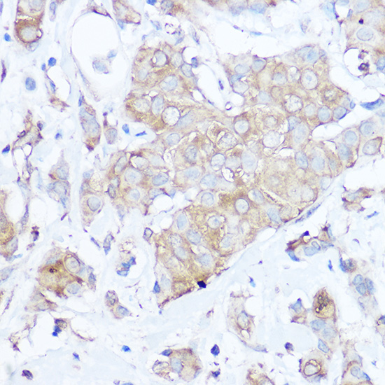MGP Rabbit Polyclonal Antibody - Image 2