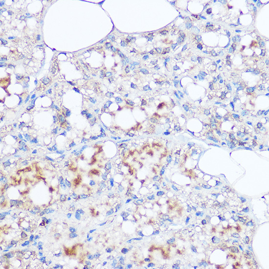 MGP Rabbit Polyclonal Antibody - Image 3