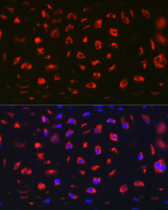 MGP Rabbit Polyclonal Antibody - Image 4