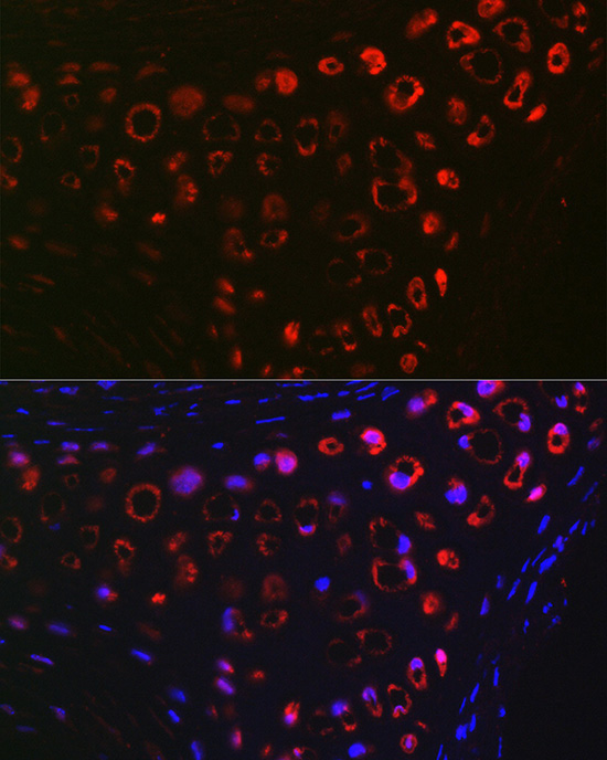 MGP Rabbit Polyclonal Antibody - Image 5