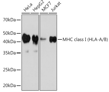 MHC class I (HLA-A/B) Rabbit Monoclonal Antibody