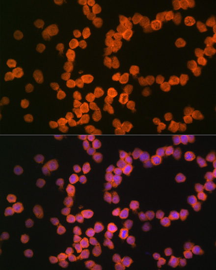 MHC class I (HLA-A/B) Rabbit Monoclonal Antibody - Image 2