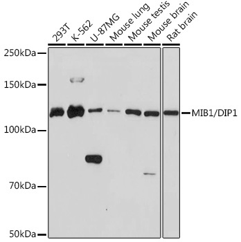 MIB1/DIP1 Rabbit Monoclonal Antibody