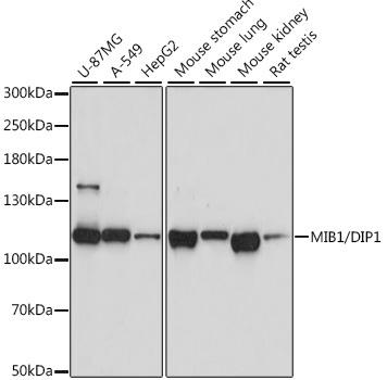 MIB1/DIP1 Rabbit Polyclonal Antibody