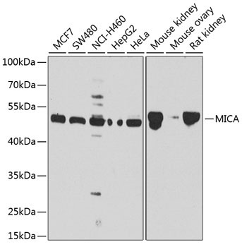 MICA Rabbit Polyclonal Antibody