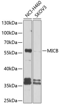 MICB Rabbit Polyclonal Antibody