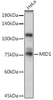 MID1 Rabbit Polyclonal Antibody