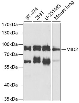 MID2 Rabbit Polyclonal Antibody