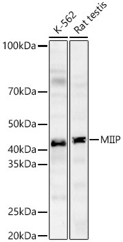 MIIP Rabbit Polyclonal Antibody