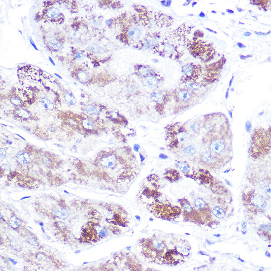 Mineralocorticoid receptor (NR3C2) Rabbit Polyclonal Antibody - Image 2