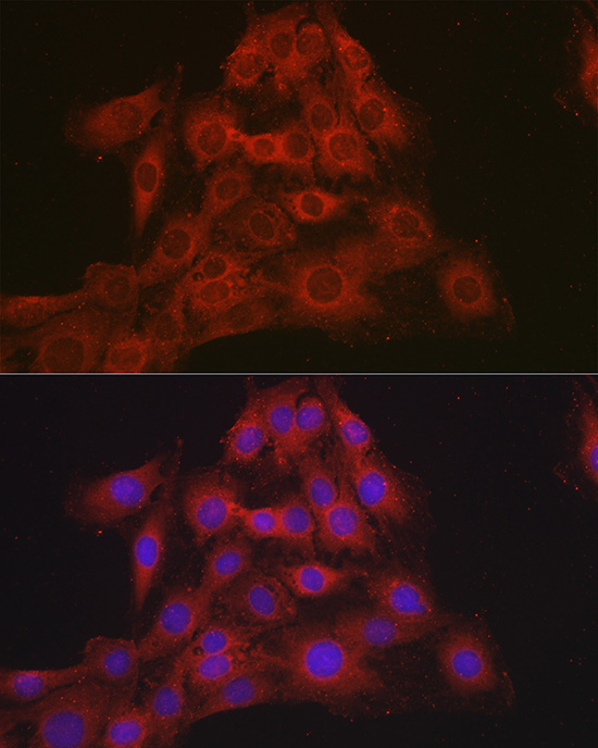Mineralocorticoid receptor (NR3C2) Rabbit Polyclonal Antibody - Image 3