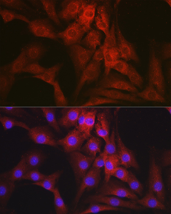 Mineralocorticoid receptor (NR3C2) Rabbit Polyclonal Antibody - Image 4