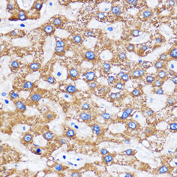 MITD1 Rabbit Polyclonal Antibody - Image 2