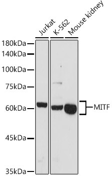 MITF Rabbit Polyclonal Antibody