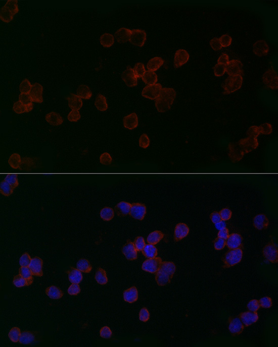 Mitofusin 2 Rabbit Polyclonal Antibody - Image 2