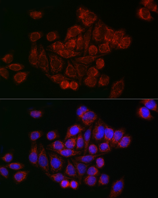 Mitofusin 2 Rabbit Polyclonal Antibody - Image 3