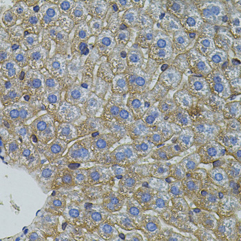 Mitofusin 2 Rabbit Polyclonal Antibody - Image 2