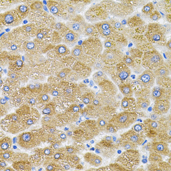 Mitofusin 2 Rabbit Polyclonal Antibody - Image 3