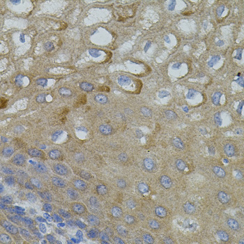 Mitofusin 2 Rabbit Polyclonal Antibody - Image 4