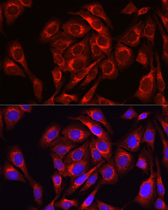 Mitofusin-1/MFN1 Rabbit Polyclonal Antibody - Image 3