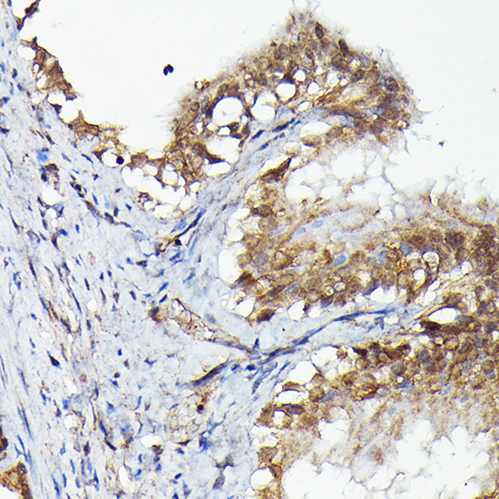 MKNK1 Rabbit Polyclonal Antibody - Image 2
