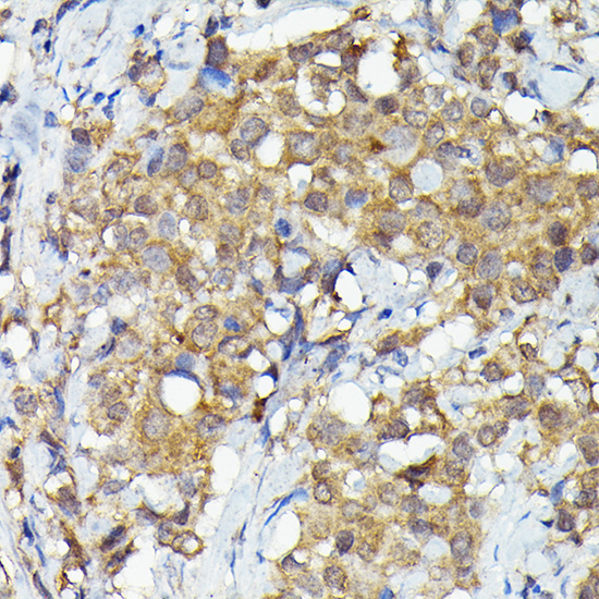 MKNK1 Rabbit Polyclonal Antibody - Image 3