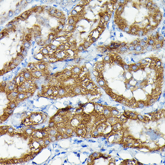 MKNK1 Rabbit Polyclonal Antibody - Image 4