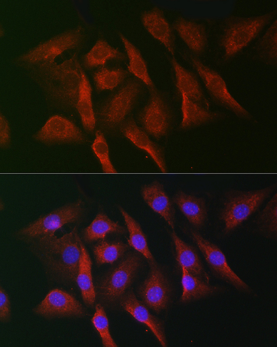 MKNK1 Rabbit Polyclonal Antibody - Image 5