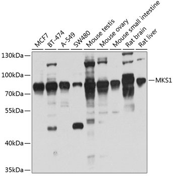 MKS1 Rabbit Polyclonal Antibody