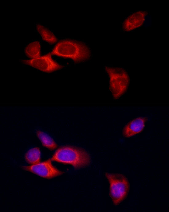 MLKL Rabbit Polyclonal Antibody