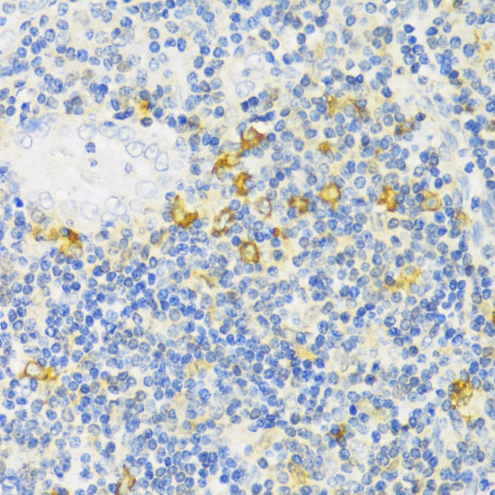 MLKL Rabbit Polyclonal Antibody