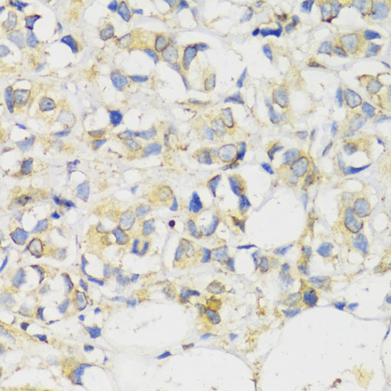 MLKL Rabbit Polyclonal Antibody - Image 2