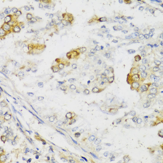 MLKL Rabbit Polyclonal Antibody - Image 3