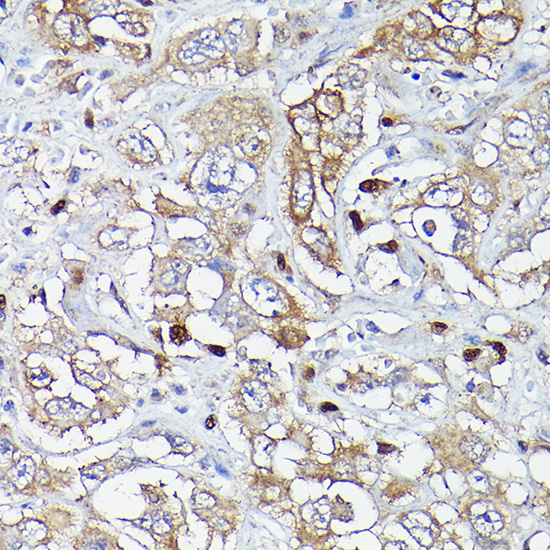 MLKL Rabbit Polyclonal Antibody - Image 2