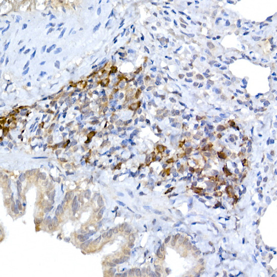 MLL5 Rabbit Polyclonal Antibody - Image 2