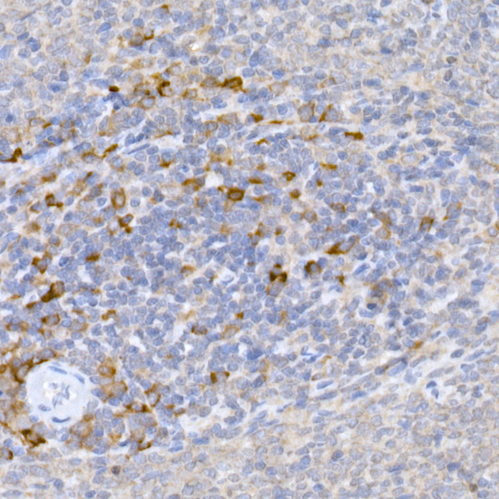 MLL5 Rabbit Polyclonal Antibody - Image 3