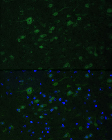 MLL5 Rabbit Polyclonal Antibody - Image 4