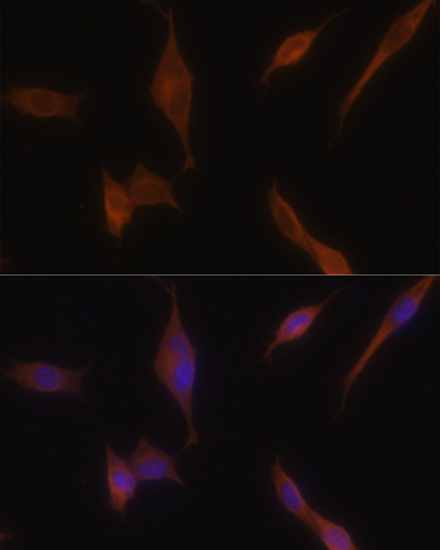 MLPH Rabbit Polyclonal Antibody - Image 2