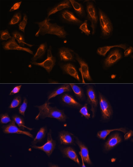 MLPH Rabbit Polyclonal Antibody - Image 3