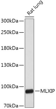 MLXIP Rabbit Polyclonal Antibody
